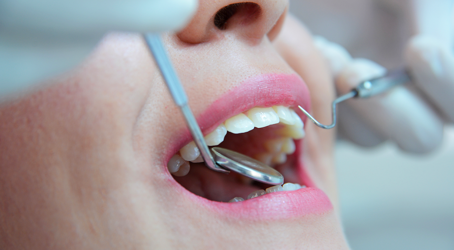 woman at dentist office in san mateo receiving oral exam with dental appliances in her mouth